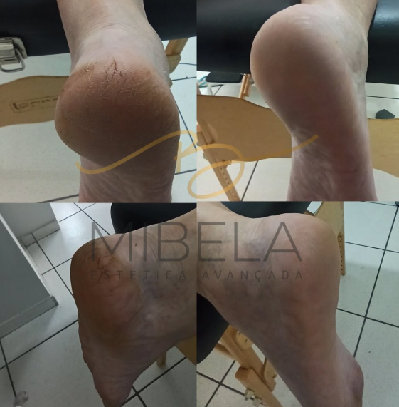 Espaço Mibela Estética